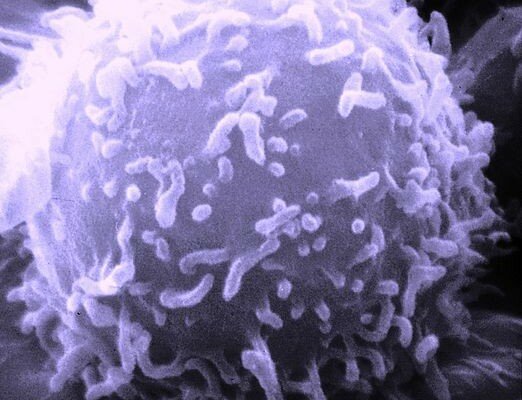 SEM_Lymphocyte